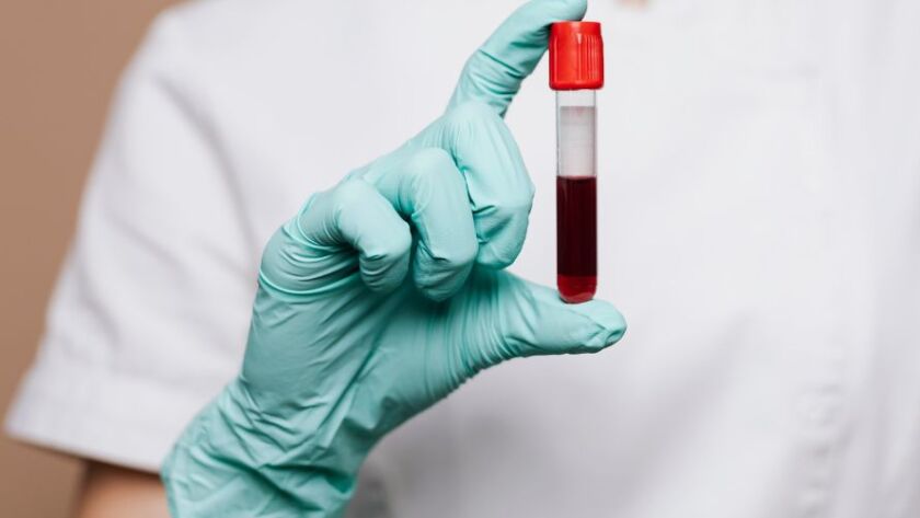 exame-de-dna-pode-ser-feito-em-parentes-do-suposto-pai